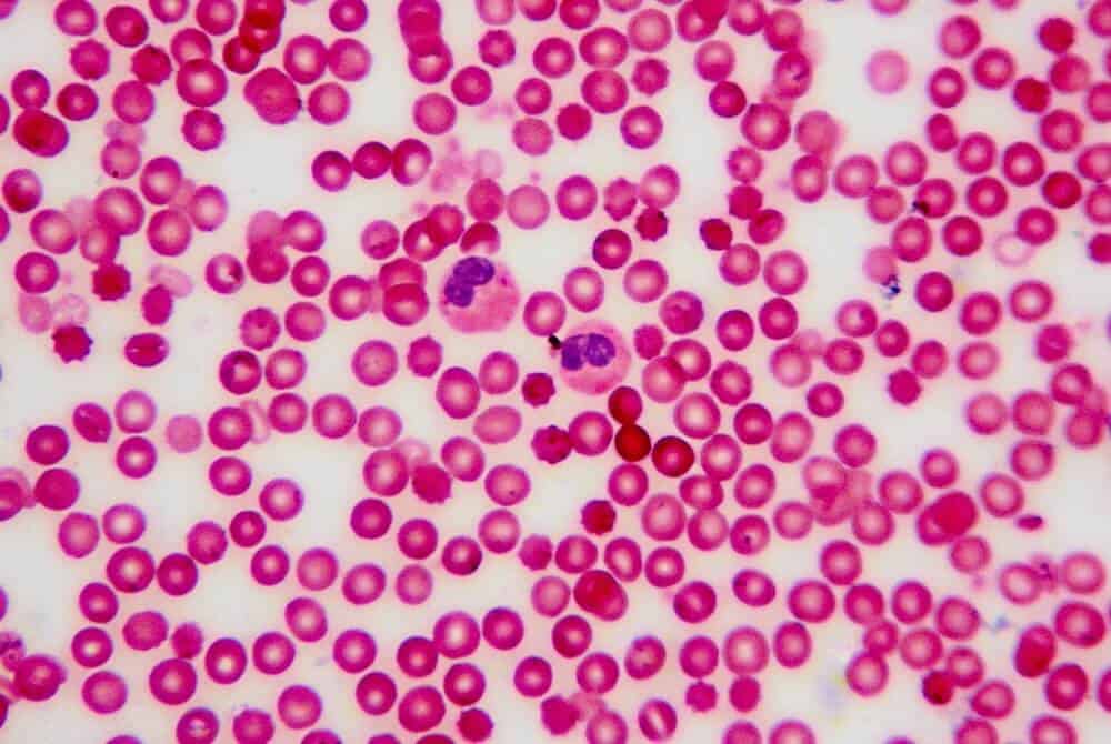 Red blood cell smear on microscope slide